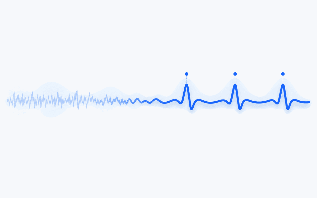 Illustration of a noisy signal trace on the left resolving into a clean pulse waveform with marked heartbeats on the right