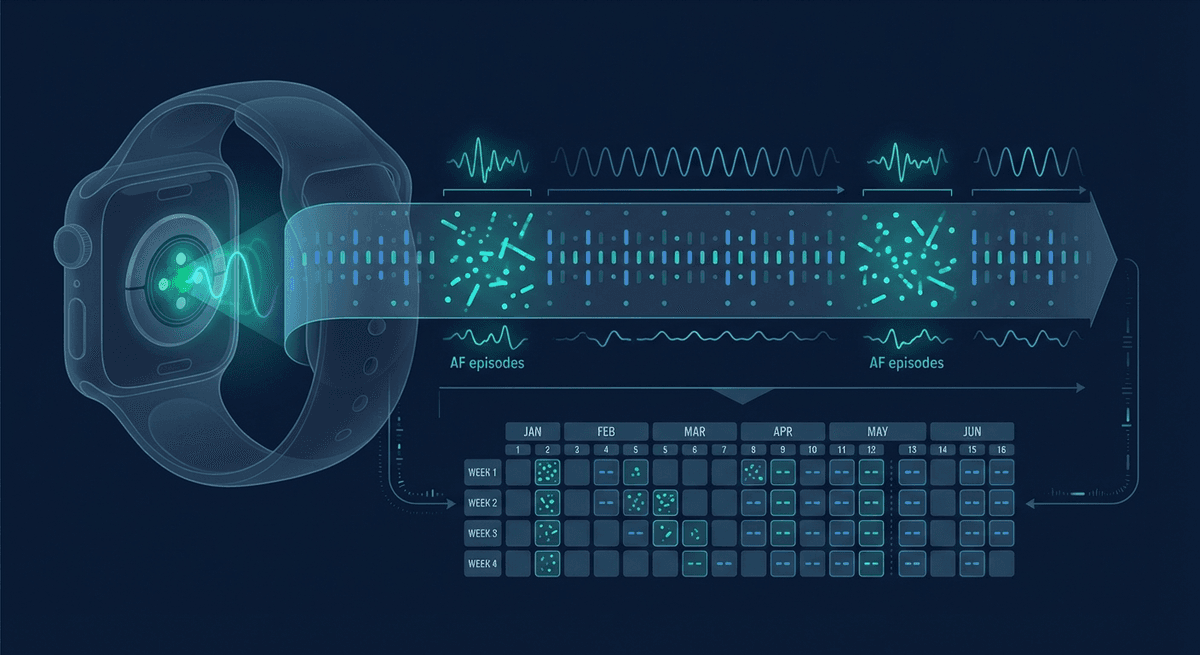 PPG AF Burden Monitoring: What Wearables Can and Cannot Tell You About Atrial Fibrillation Load