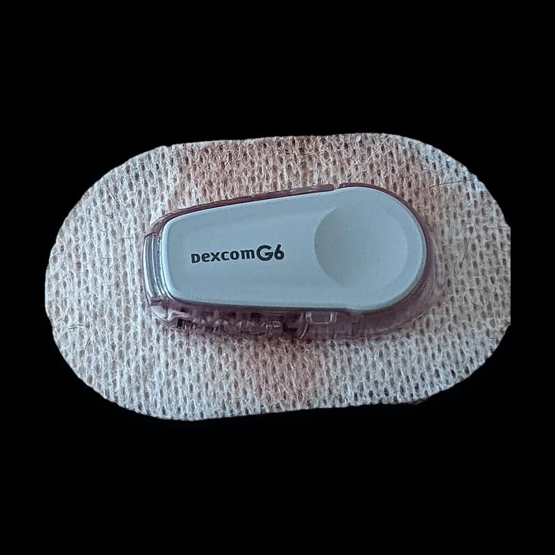 Dexcom G6 CGM photo